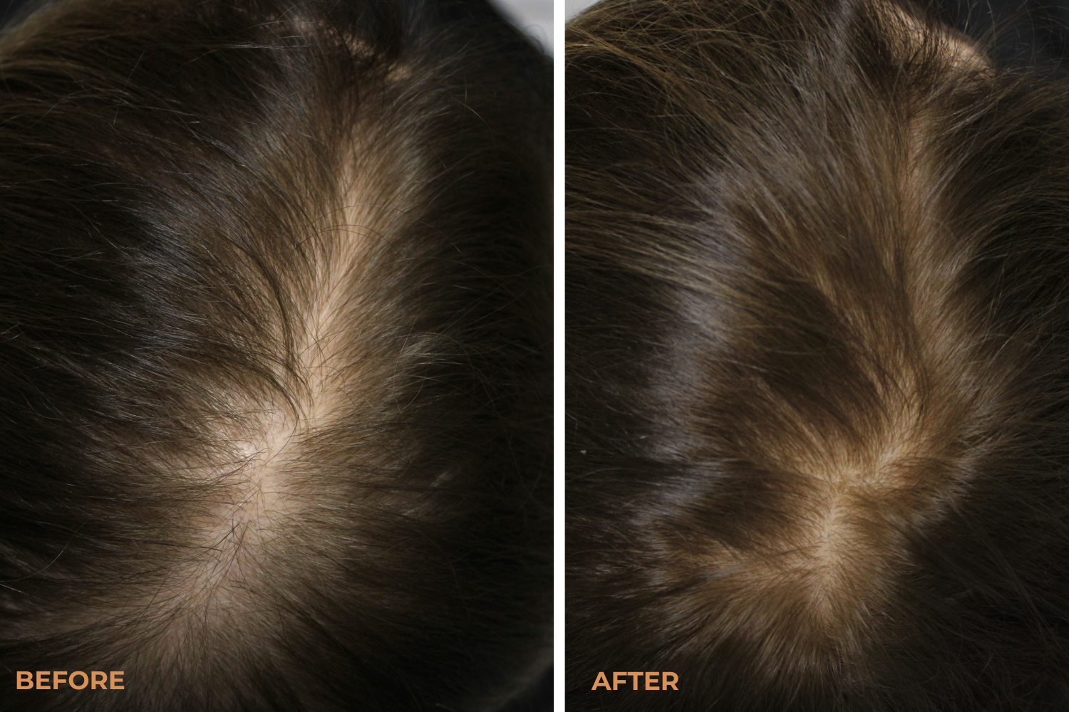 Before and After - Peaureva